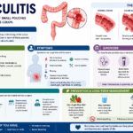 Diverticulitis
