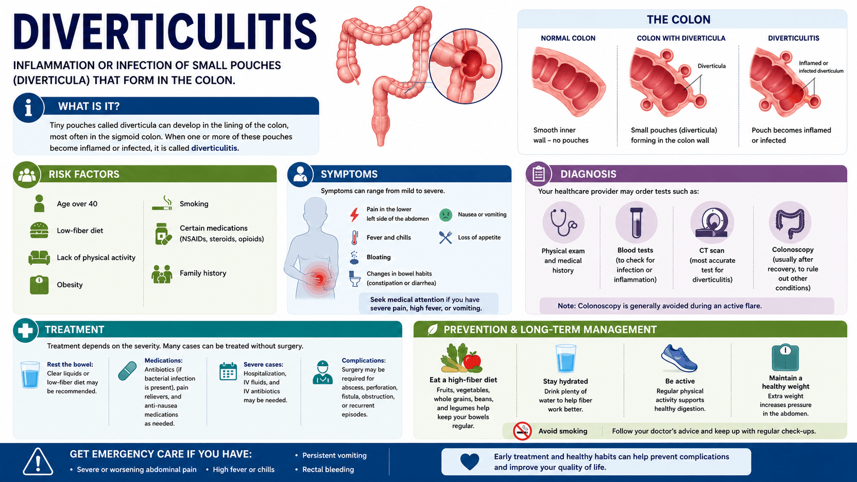 Diverticulitis